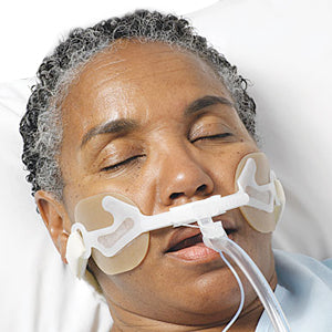 Anchor Fast Oral Endotracheal Tube Fastener 1 Each