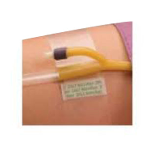 Hold-n-Place Foley Catheter Holder Adhesive Patch, One Size Fits All 1 Each