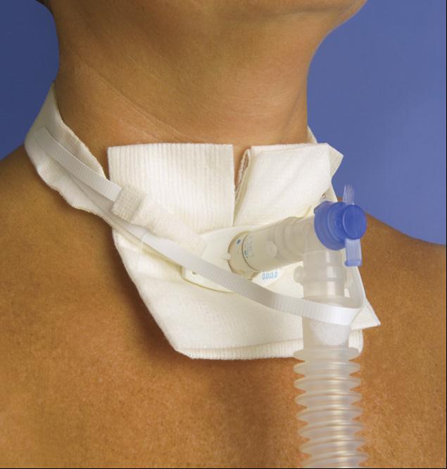 One-Piece Adult Trach-Tie with Ventilator Anti-Disconnect Device 1 Each