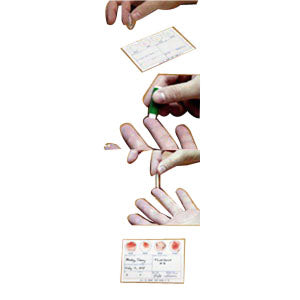Smiths Medical ASD, Inc. Line Draw Blood Gas Kit wit 3 mL Syringe 200 Case